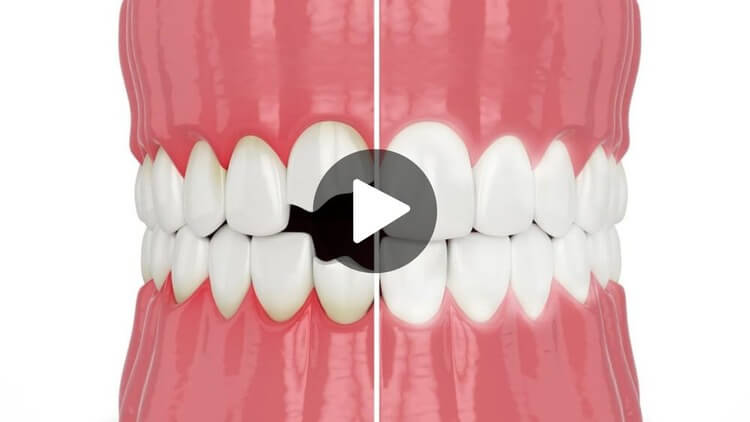 Thumbnail image for an educational video on cosmetic dentistry